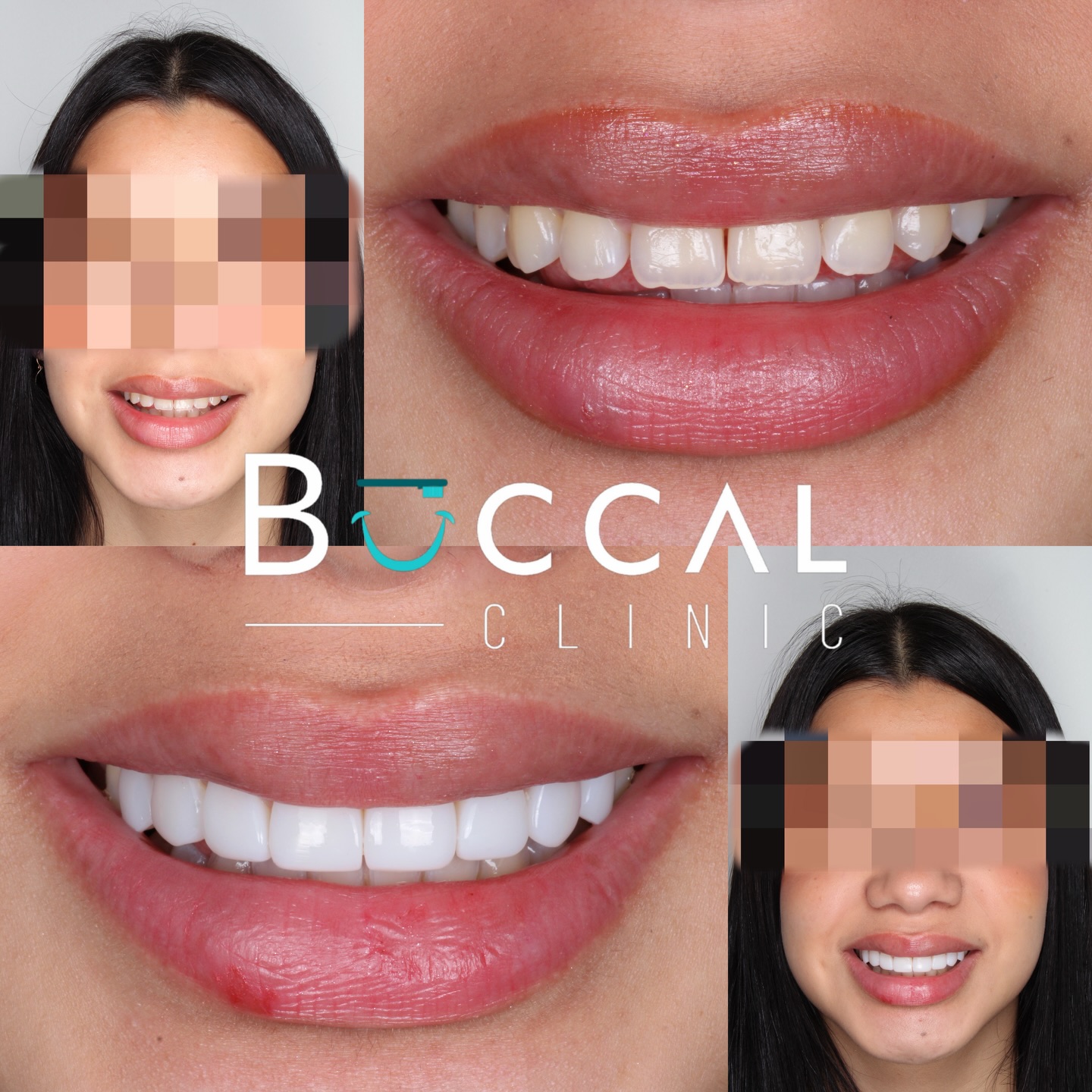 Rehabilitación oral