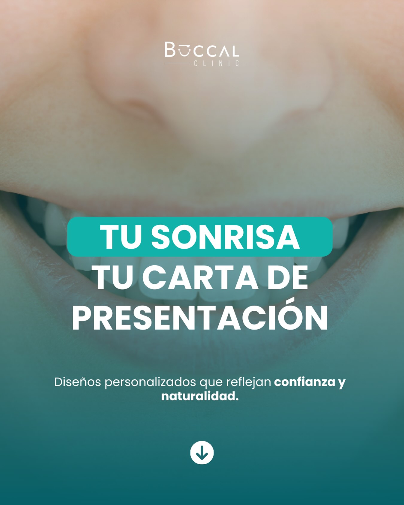 Diseño de sonrisa