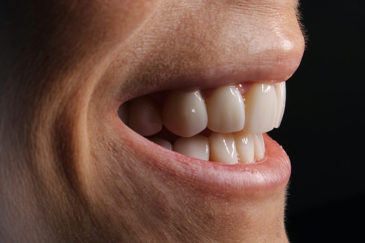 Diseño de Sonrisa Buccal Clinic