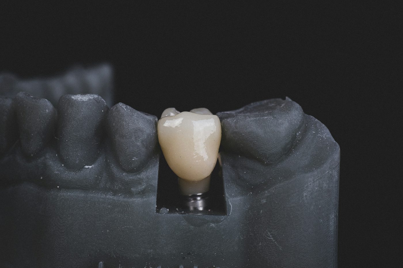 Implantología Buccal Clinic