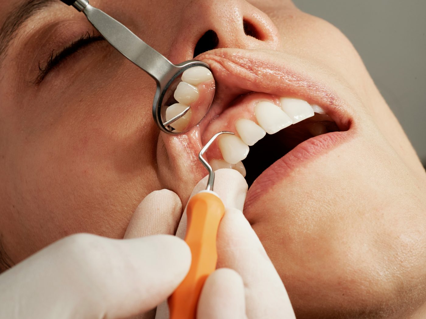 Periodoncia Buccal Clinic