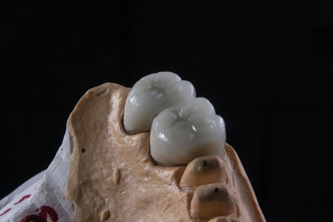 Rehabilitación Oral Buccal Clinic